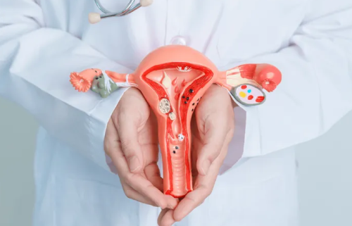 تشخيص الأورام الليفية الرحمية